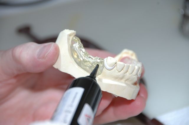 maqueta dental